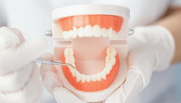 歯の模型を使って説明するすえひろ歯科のスタッフ